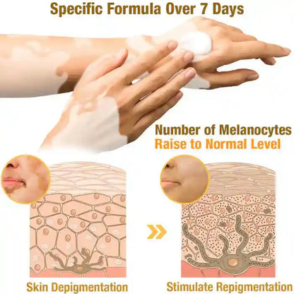 New Revitalizing Bee Venom Cream Natural Skin Restoration. Buy 1 - Get 2 Free. Pay only ₹599 (Save ₹900)